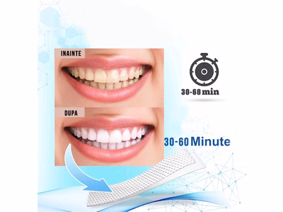 Set Benzi pentru albirea dintilor cu carbune activat NeoSimply - rezultate