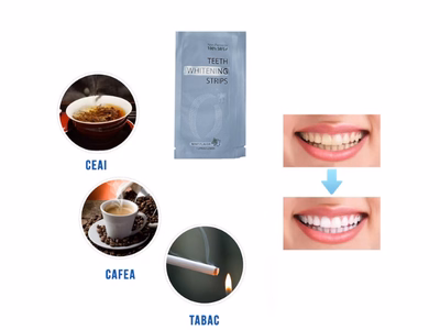 Set Benzi pentru albirea dintilor cu carbune activat NeoSimply - aplicare
